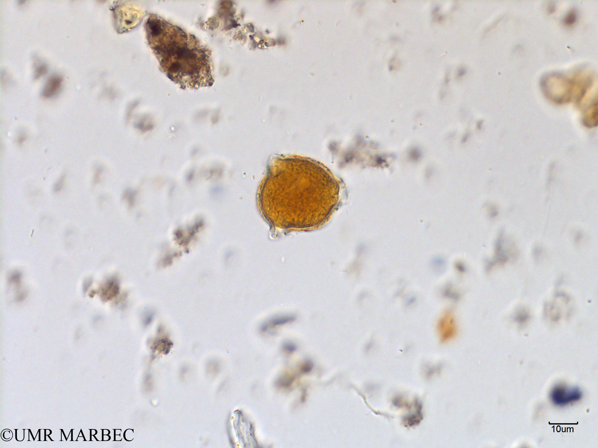 phyto/Scattered_Islands/mayotte_lagoon/SIREME May 2016/Triceratium sp6 (MAY2_triceratium a confirmer-6).tif(copy).jpg